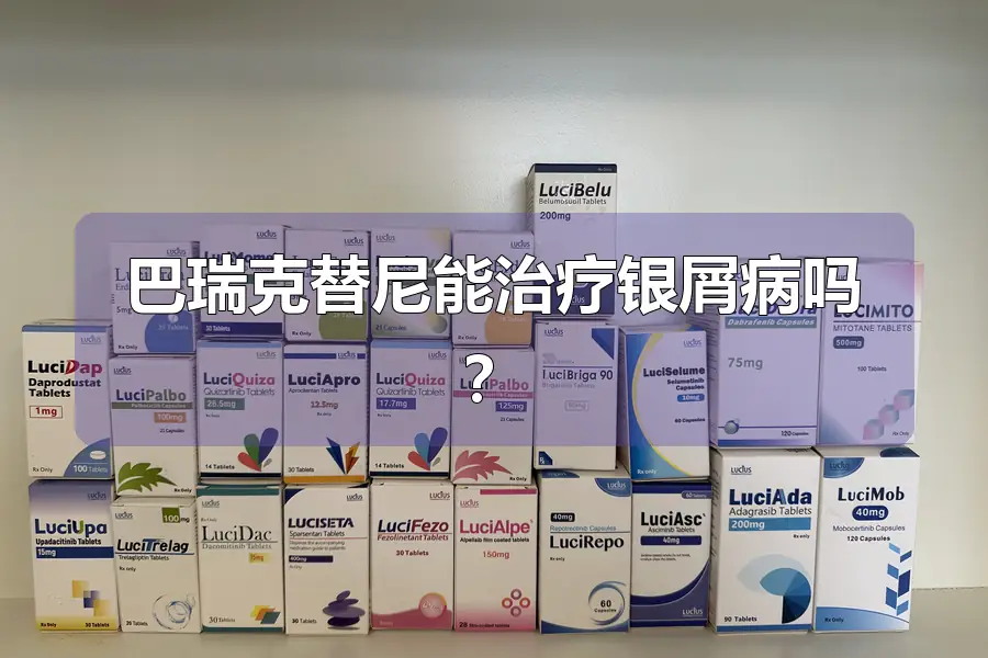 巴瑞克替尼能治疗银屑病吗?