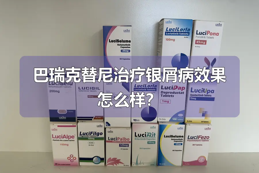 巴瑞克替尼治疗银屑病效果怎么样?
